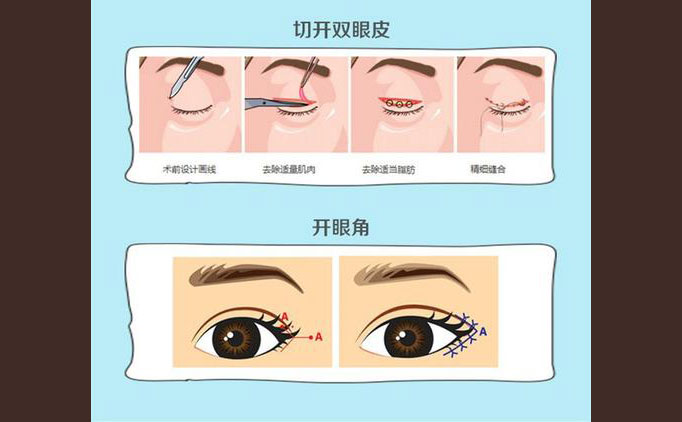 眼部修復手術包括什么項目？