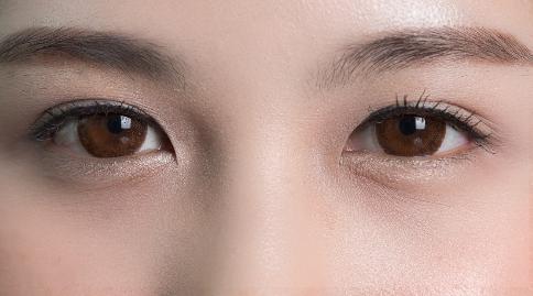 上眼皮松弛是什么原因引起的？