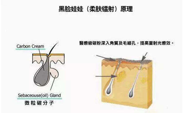 黑臉娃娃是什么？