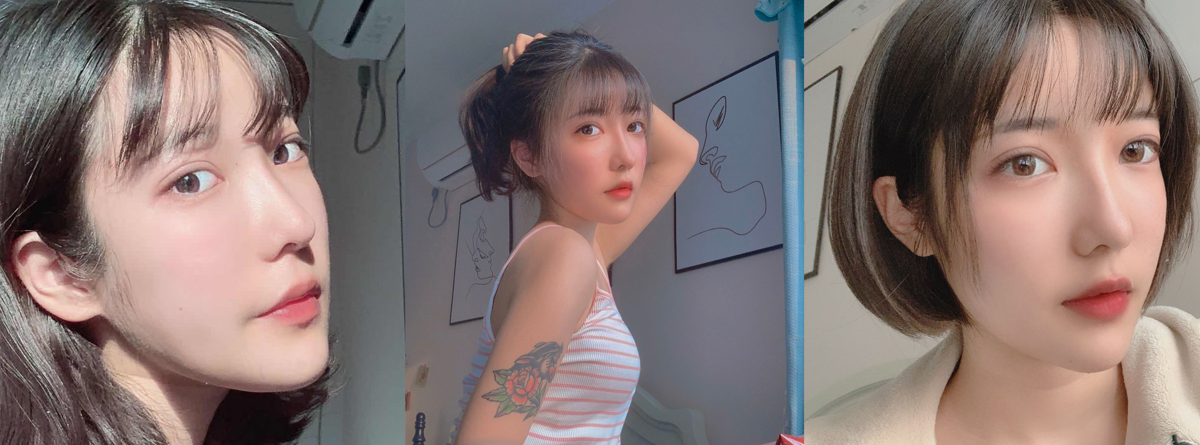 杭州時(shí)光自體脂肪填充效果圖2