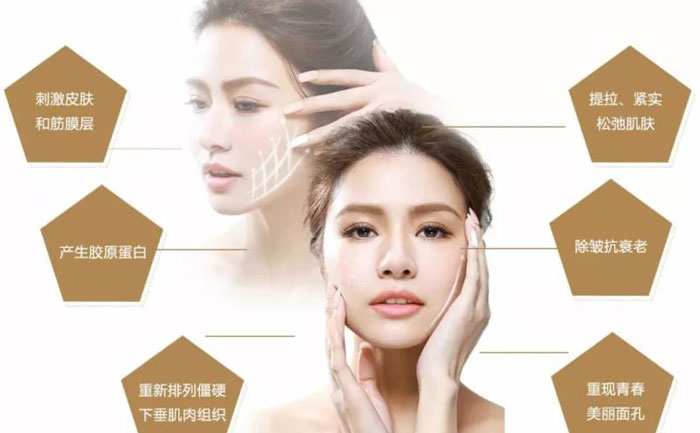 微整形面部提升價格多少？微整形面部提升能保持多久？
