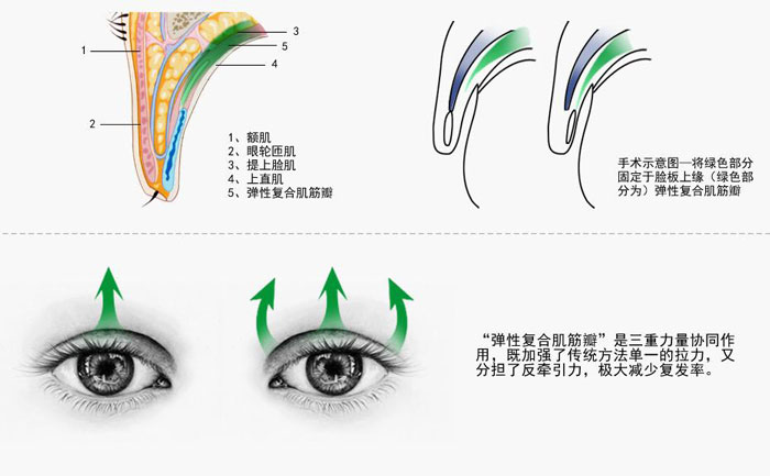上瞼下垂的癥狀有哪些？