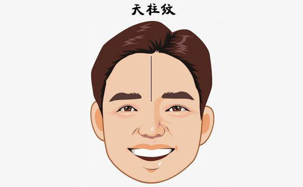 硅膠填充額頭安全嗎？