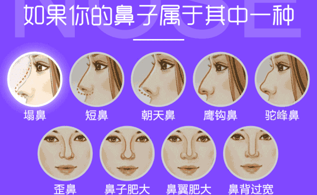 自體脂肪隆鼻可以保持多久？