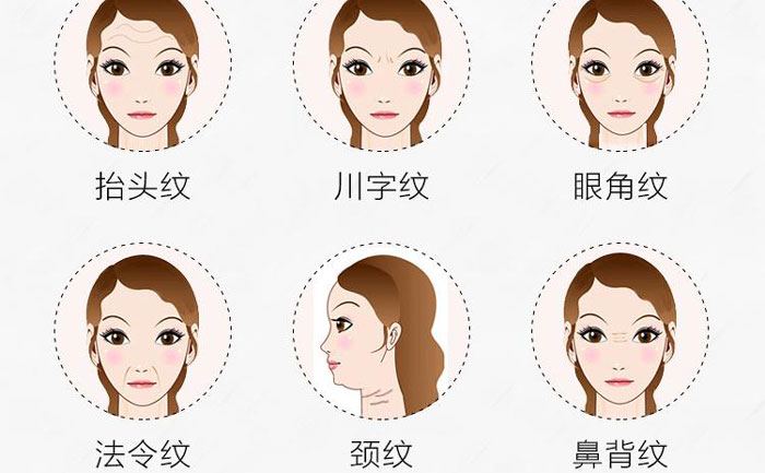 botox除皺針有哪些副作用？