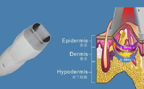 射頻除皺的效果好嗎？