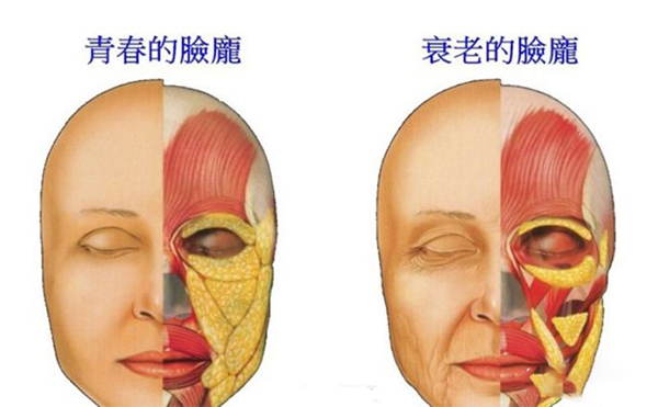 電波拉皮的誤區(qū)？