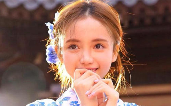 愛貝芙墊下巴適合什么樣的人?術后護理要點有哪些?
