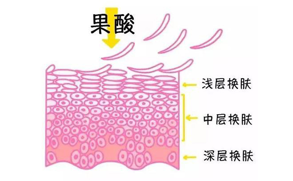 果酸煥膚的作用有哪些？