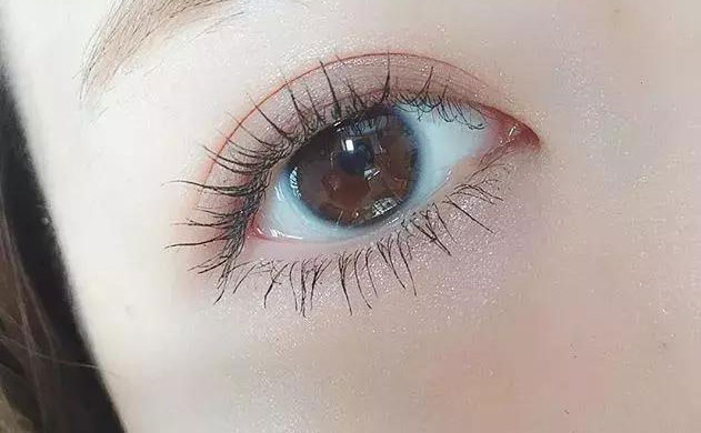 激光雙眼皮手術(shù)多少錢？激光雙眼皮手術(shù)需要多久恢復(fù)時(shí)間？