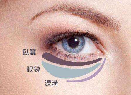 眼袋失敗修復要怎么處理？切眼袋需要多長時間恢復？