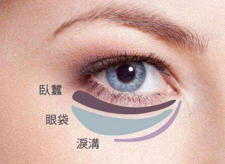 眼袋失敗修復要怎么處理？切眼袋需要多長時間恢復？