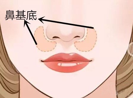 做玻尿酸墊鼻基底風(fēng)險(xiǎn)有哪些？深圳市玻尿酸豐鼻基底大概需要費(fèi)用？