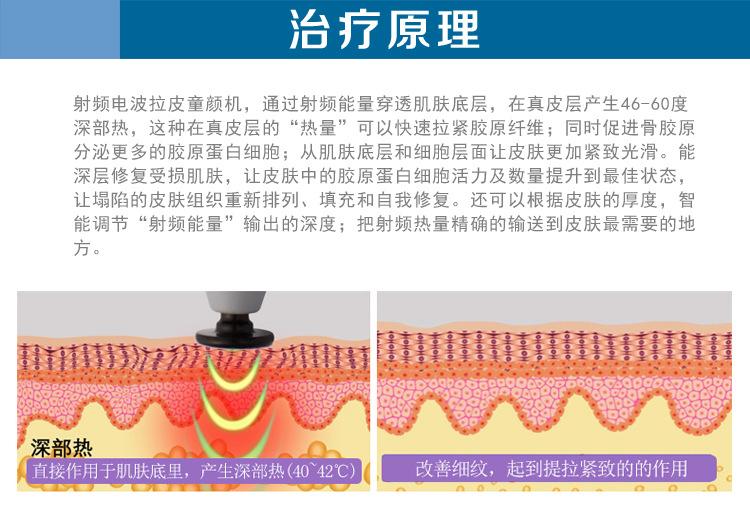  射頻緊膚的效果到底怎么樣呢？射頻緊膚多久做一次？