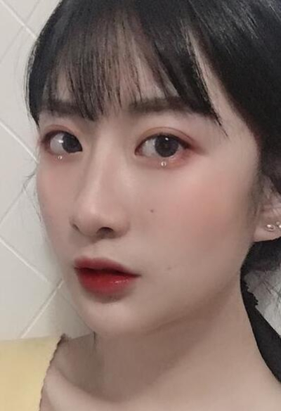 珠海陸達美容外科醫(yī)院做下頜角術(shù)后效果恢復的很好