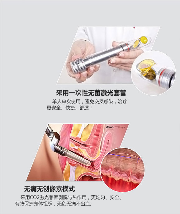 成都愛爾麗整形激光緊縮陰道怎么樣？激光緊縮陰道注意什么？