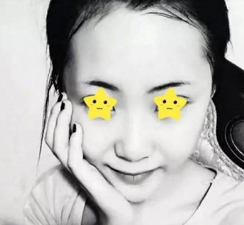 做綜合鼻，上海首爾麗格安建榮鼻綜合真人案例照片