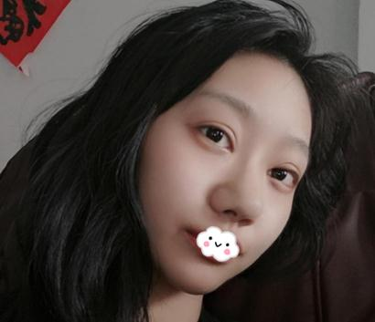 上海伊美爾港華做的3w的鼻子，你們說值不值