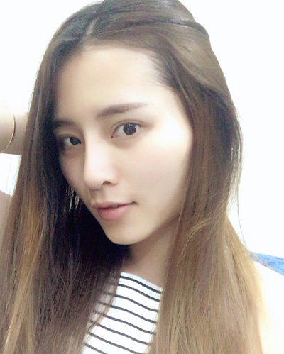 深圳微姿醫(yī)療美容門診部做鼻綜合手術(shù)后的日?；謴?fù)