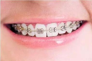 常州瀚景口腔牙齒拋光怎么樣？牙齒拋光有什么作用？