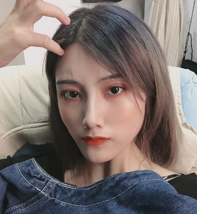 上海港華醫(yī)療美容醫(yī)院做隆鼻的恢復情況